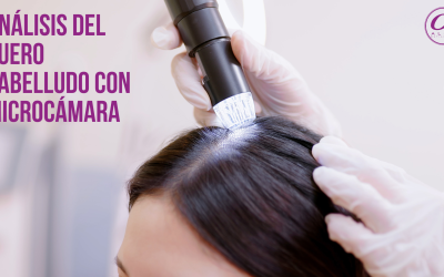 DESCUBRE EL SECRETO PARA UN CABELLO SANO: BENEFICIOS DEL TEST DE MICROCÁMARA PARA TU CUERO CABELLUDO